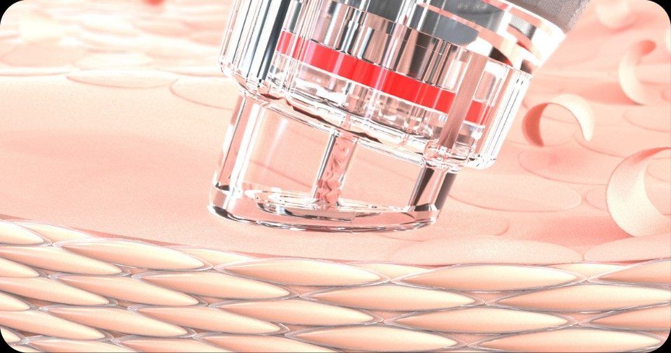 Proceso de exfoliación facial mediante hidrodermoabrasión con el equipo EVE Ace of Face